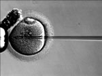 in-vitro1